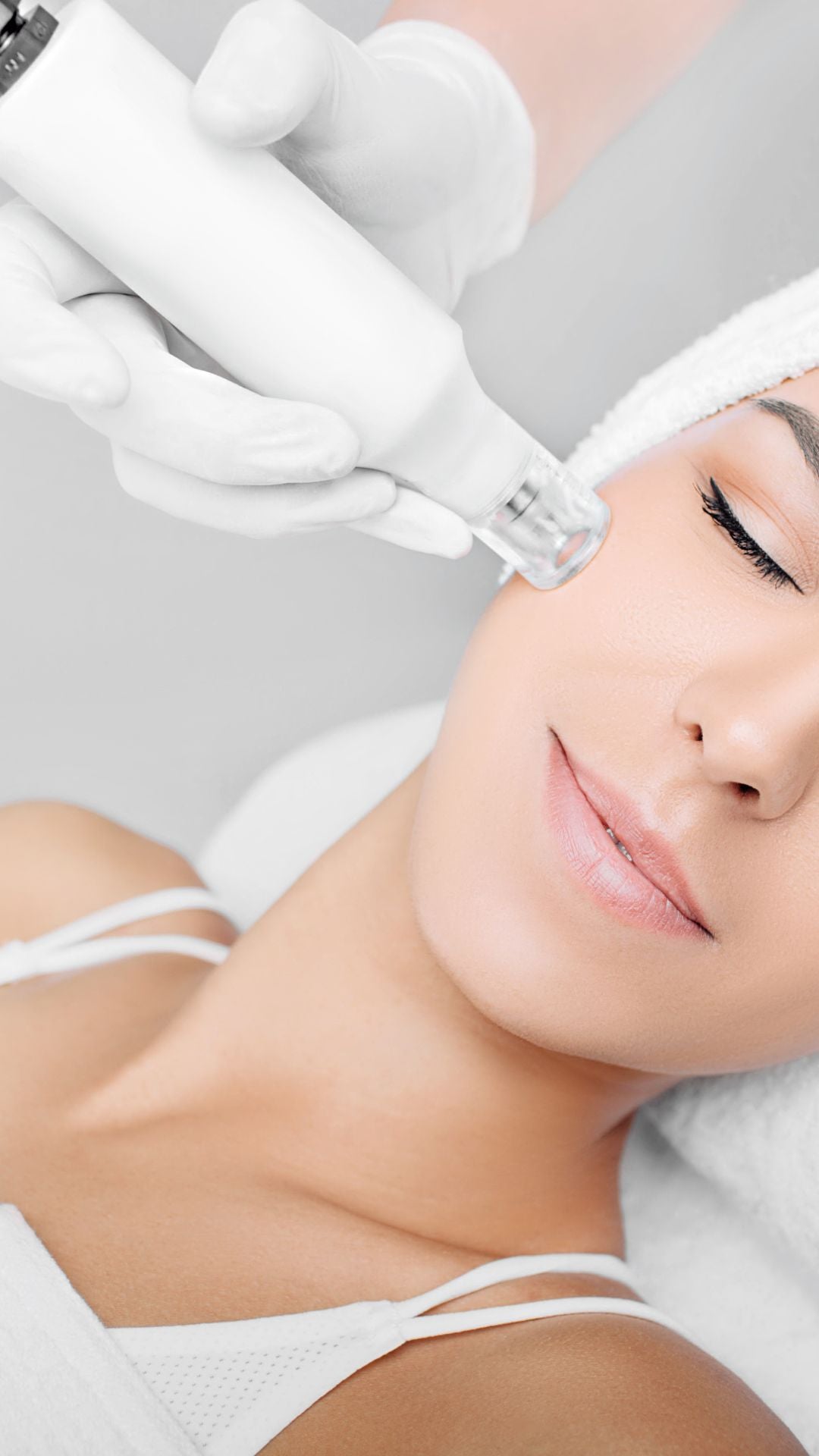 Micro Needling Skin Correction