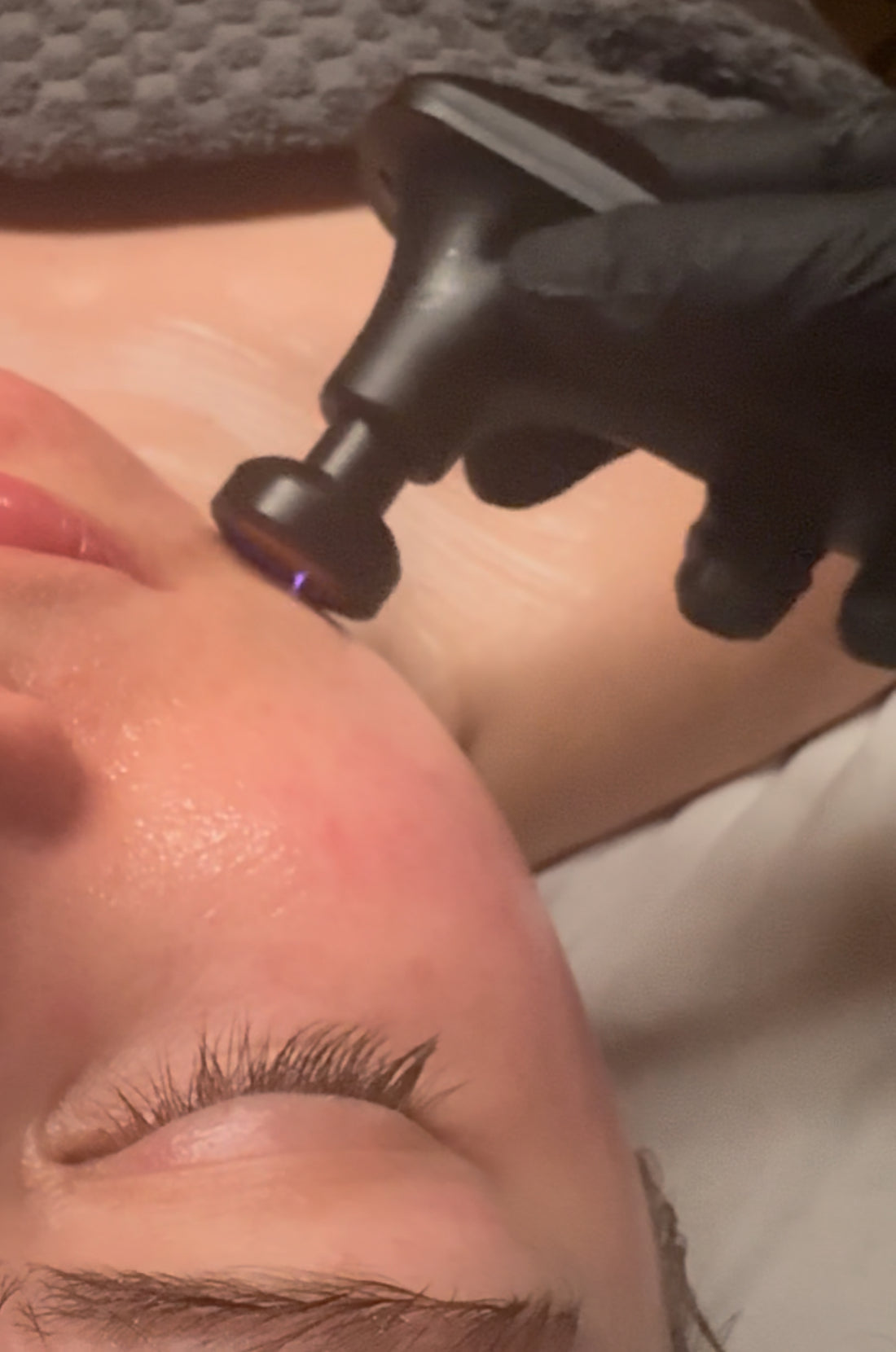 The Skin Power Cell Cold Plasma Facial