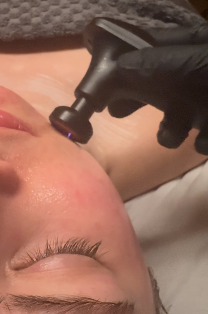 The Skin Power Cell Cold Plasma Facial